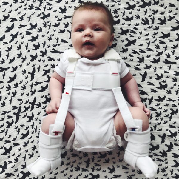 Baby boy in pavlik harness for hip dysplasia