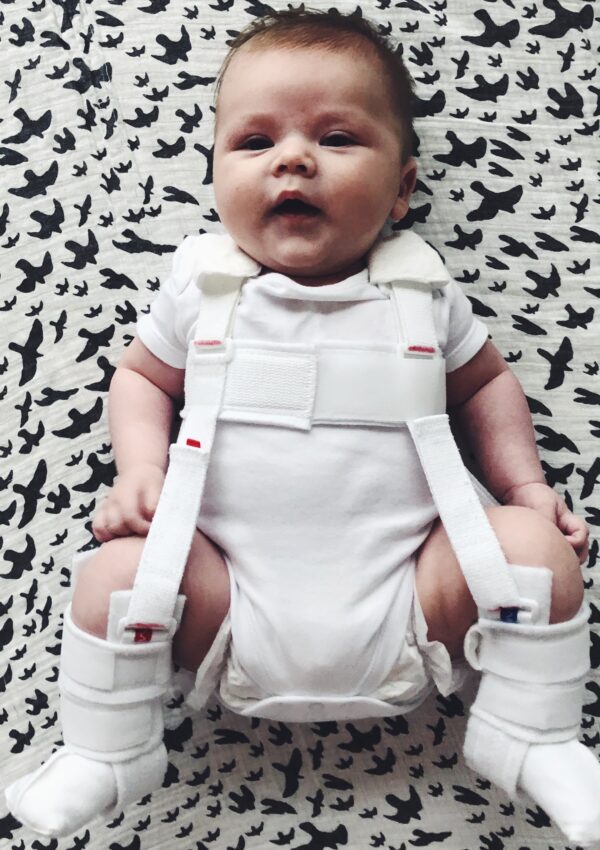 Our hip dysplasia journey- from double nappies to the Pavlik harness