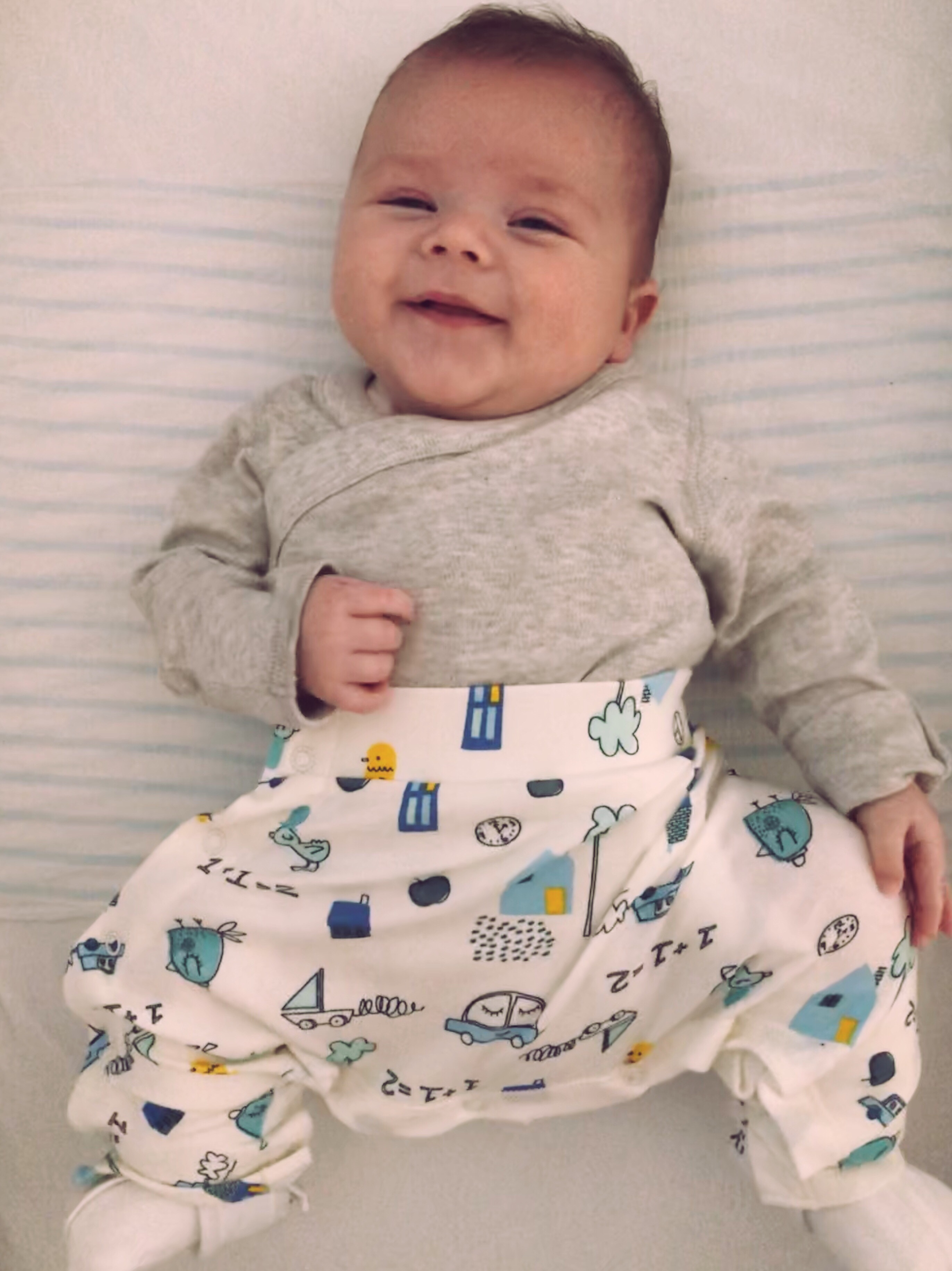 Baby DDH hip dysplasia pavlik harness