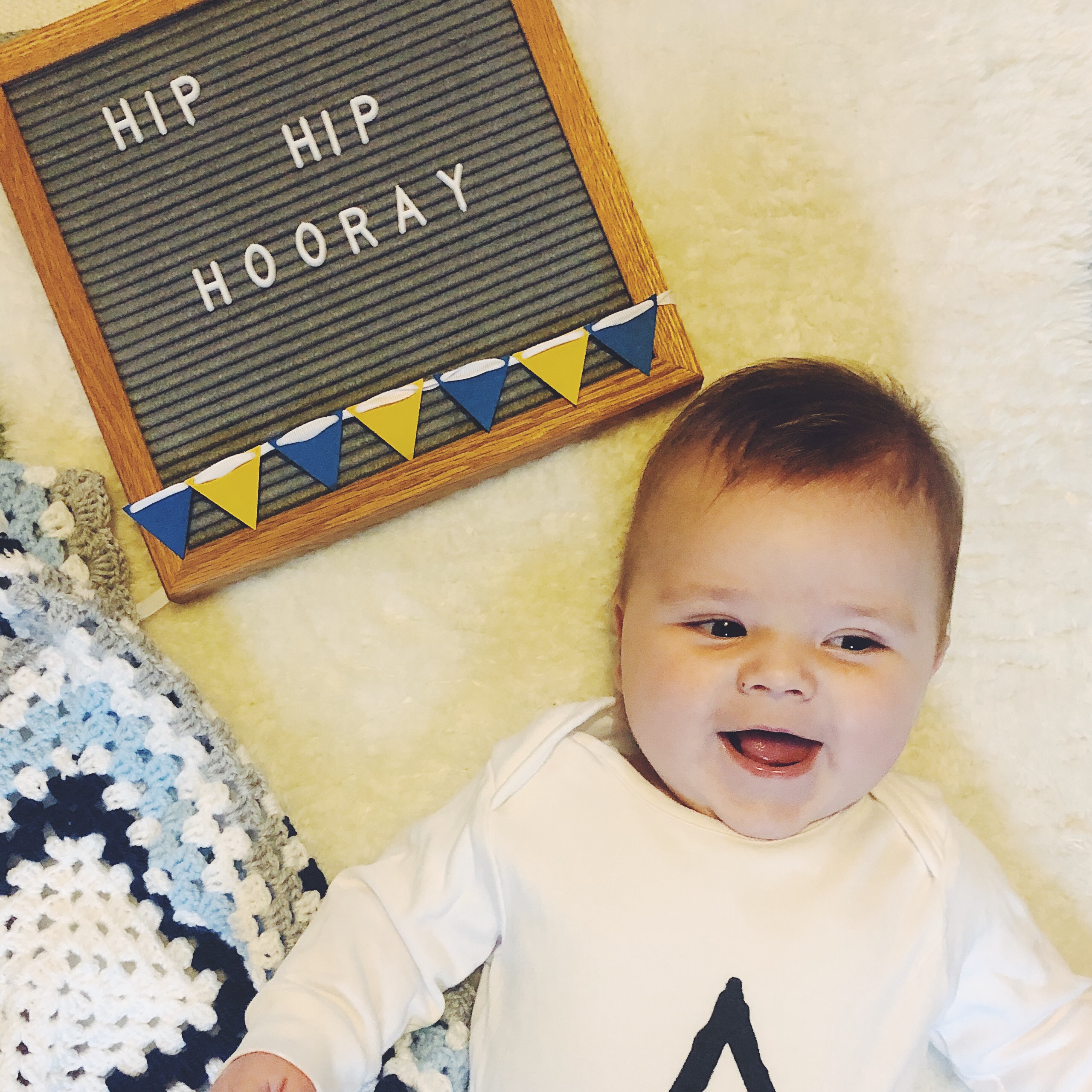 Baby DDH hip dysplasia pavlik harness